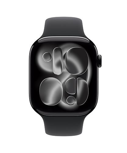 The Apple Watch Series 11 viewed from the front.
