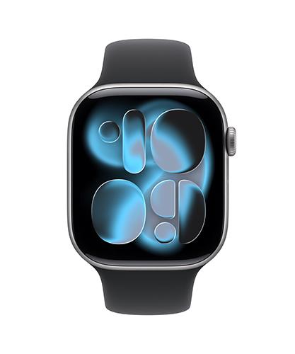 The Apple Watch Series 11 viewed from the front.